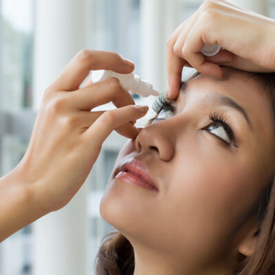 Diet and Natural Treatments for Dry Eyes